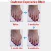 Silky Soft Toe Aligners